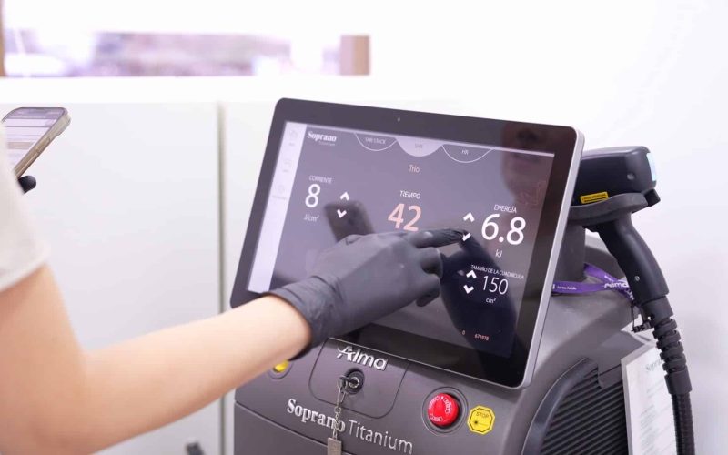 depilasion laser mano sopranotitanium